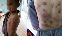 Lời khai bất ngờ của cháu bé bị sư thầy bạo hành ở Thanh Hóa