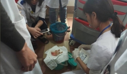 Chủ quán ăn bị chém lìa tay vì ngăn xe ôm chèo kéo khách