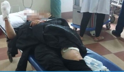 Thông tin bất ngờ vụ tài xế taxi bị chém đứt tay