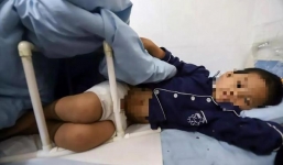 Bé trai bị mẹ kế bắt uống thuốc tẩy, đổ nước sôi lên người