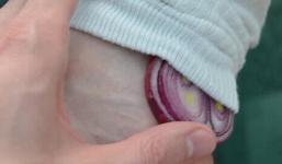 Đặt hành tây vào tất chân khi đi ngủ: Đừng buồn cười khi chưa kiểm chứng hiệu quả kỳ diệu