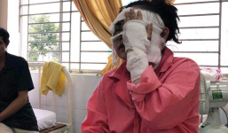 Cô gái sắp cưới bị tạt axit tại Sài Gòn: Có thể bị mù vĩnh viễn