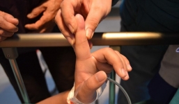 Thiếu nữ 14 tuổi sốc phản vệ và nguy kịch sau khi bị kiến cắn