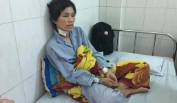 Người phụ nữ bị chồng cũ cắt tai, bạo hành dã man vì xin tiền không cho