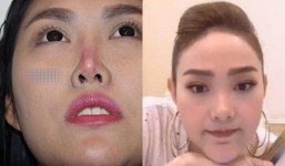 Tin tức giải trí ngày 10/1/2019: Khuôn mặt đáng sợ sau phẫu thuật thẩm mỹ của sao Việt