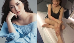 Chứng bệnh Hương Tràm mắc phải nguy hiểm như thế nào?