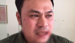 Phó Thủ tướng yêu cầu xử lý nghiêm vụ nhân viên an ninh sân bay bị 'cò' taxi đánh gãy răng