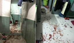 Hàng chục đối tượng xông vào phòng trọ chém 4 người bị thương nặng ở TP HCM