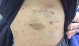 Tạm giữ hình sự ông trùm 'điều đào' dùng kéo tra tấn thiếu nữ như thời trung cổ