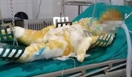 Điện Biên: Chồng say rượu tẩm xăng thiêu sống vợ, 5 đứa con nhỏ lâm vào cảnh mồ côi