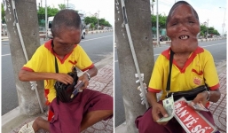 Cay mắt trước hoàn cảnh người đàn ông có 'gương mặt quỷ', bán vé số mưu sinh nhưng không ai dám mua vì sợ
