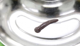 Kinh hoàng gắp đỉa trâu gần 10 cm sống trong cổ họng người đàn ông ở Phú Thọ