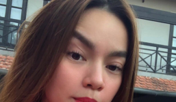 Hồ Ngọc Hà đăng ảnh mí mắt biến dạng khiến fan phát hoảng