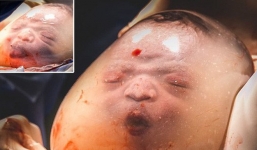 Em bé gây 'bão' MXH vì vừa nằm trong túi ối vừa làm trò, trêu chọc mọi người