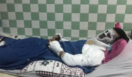 Nạn nhân bị tạt axit khi được đưa vào viện đã hỏi anh trai: 'Sao anh làm vậy với em'