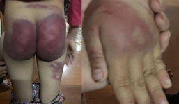 Bé gái 8 tuổi bị bạo hành ở Thanh Hóa: Bố trói hai tay vào cột nhà và dùng roi tre đánh rất mạnh