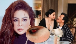 Bạn thân Trấn Thành bất ngờ thông báo tình hình sức khỏe khiến dân tình lo lắng