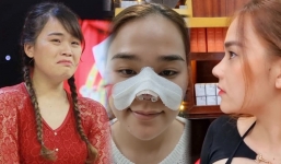 Sửa nhưng không ưng, 'thánh sún' Ngân Thảo hối hận vì đã can thiệp dao kéo: Nhan sắc hiện thế nào?