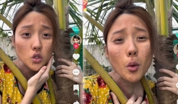 Uyển Ân - em gái Trấn Thành bắt trend biến hình xấu xí bị nghi dao kéo một bộ phận