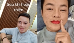 Chồng cô dâu 62 tuổi gây bất ngờ với dung mạo sau khi 'đập đi xây lại'