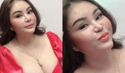 Lê Giang than thở 'tan nát khuôn mặt' vì bị bỏng, con gái nói câu phũ phàng