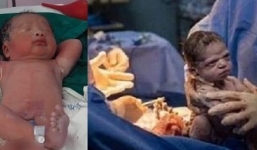 Bé sơ sinh vừa sinh ra đã có tư thế ngủ đặc biệt 'gây bão' mạng xã hội