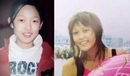 Bỏ 12 tỷ qua 300 lần phẫu thuật cô gái đổi đời, 'một bước lên tiên'