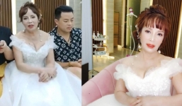 Cô dâu 62 tuổi lộ cánh tay dị dạng, nhan sắc qua camera thường khác một trời một vực