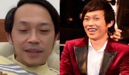 Giữa đêm Hoài Linh vội vàng livestream xin lỗi khán giả: Khuôn mặt gầy sọp mới là tâm điểm