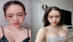 'Tình địch' của Midu lại tiếp tục 'trùng tu' nhan sắc: Diện mạo mới khiến CĐM thất vọng