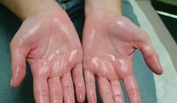 3 vị trí đổ mồ hôi báo hiệu bạn đang gặp vấn đề về sức khỏe 