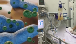 Độc tố botulinum là gì mà nguy hiểm, điều kiện phát sinh độc tố botulinum