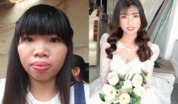 6 năm sau cuộc đại trùng tu nhan sắc, Phượng 'Thị Nở' đổi đời, cuộc sống thăng hoa