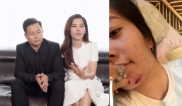 Nam Em tiều tụy khó nhận ra, rơi vào tình cảnh đáng báo động sau thị phi của chồng sắp cưới