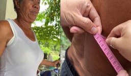 Lạ lùng người đàn ông U70 sở hữu vòng 1 to bất thường như phụ nữ