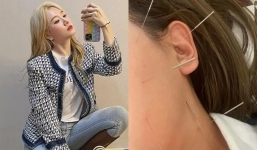 Trước khi sang Hàn Quốc điều trị bệnh, Hari Won từng để lộ thể trạng đáng lo ngại