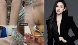 Đỗ Thị Hà lộ loạt dấu hiệu cơ thể bất ổn với nhiều vết trầy trên người