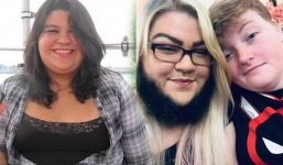 Cô gái có bộ râu dài 10 cm, tự tin với diện mạo 'khác người' của mình