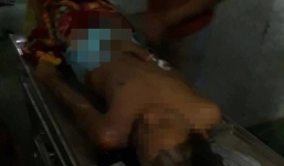 Nam thanh niên hi hữu thoát chết khi bị sét đánh tại Thanh Hóa