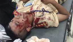 Đại úy CSGT đang làm nhiệm vụ bị người vi phạm cầm gạch đập trúng đầu