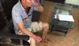 Anh trai truy sát cả nhà em trai chém cả bác sĩ đến cấp cứu