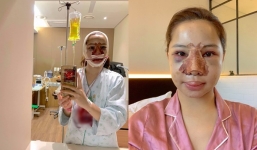 Lưu Đê Ly công khai sang Hàn Quốc đại phẫu toàn bộ gương mặt