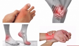 Những dấu hiệu cơ thể đang dần thiếu vitamin C