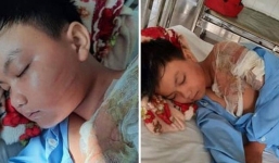 Long An: Nghi vấn cha ruột tạt nước sôi khiến bé trai 11 tuổi bị bỏng nặng