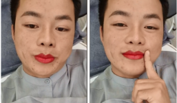 Hết đưa chồng đi nâng mũi, cô dâu 62 tuổi lại rủ chồng xăm môi
