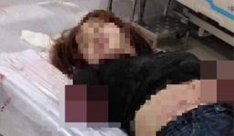 Đồng Nai: Ghen tuông, chồng nhẫn tâm chém đứt 2 cánh tay vợ