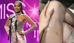 Ngọc Châu thẫn thờ khi trượt top 16, lộ đôi chân bầm tím ở Miss Universe 2022