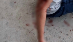 Khánh Hòa: Xác minh vụ du khách nước ngoài bị chó cắn nhập viện