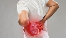 Hậu quả khôn lường vì chữa sỏi thận theo cách này