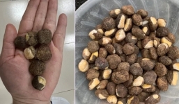 Lạng Sơn: Ăn loại hạt có hình dáng giống hạt dẻ, gần 20 người nhập viện